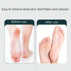 Foot Scrubbing Board Dead Skin Calluses Remover Pedicure Foot Care Tool