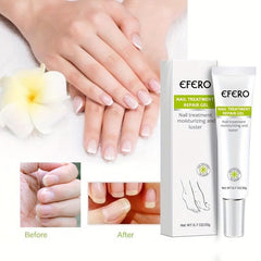 10pcs Nail Moisturizing Cream Nail Care Products for Women and Girls