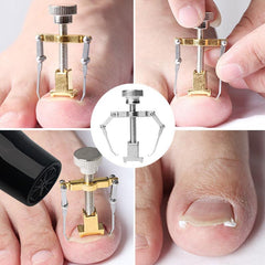 Ingrown Toenails Corrector Stainless Steel Nail Straightening Tool