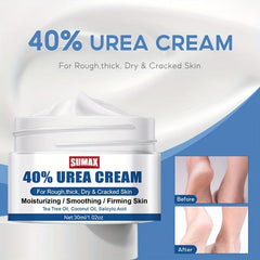 Deep Moisturizing Foot Lotion 40 Urea Cream for Rough Dry Cracked Heels