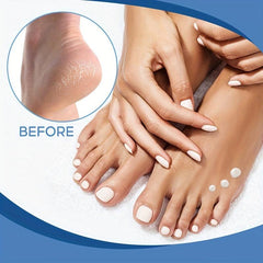 Deep Moisturizing Foot Lotion 40 Urea Cream for Rough Dry Cracked Heels