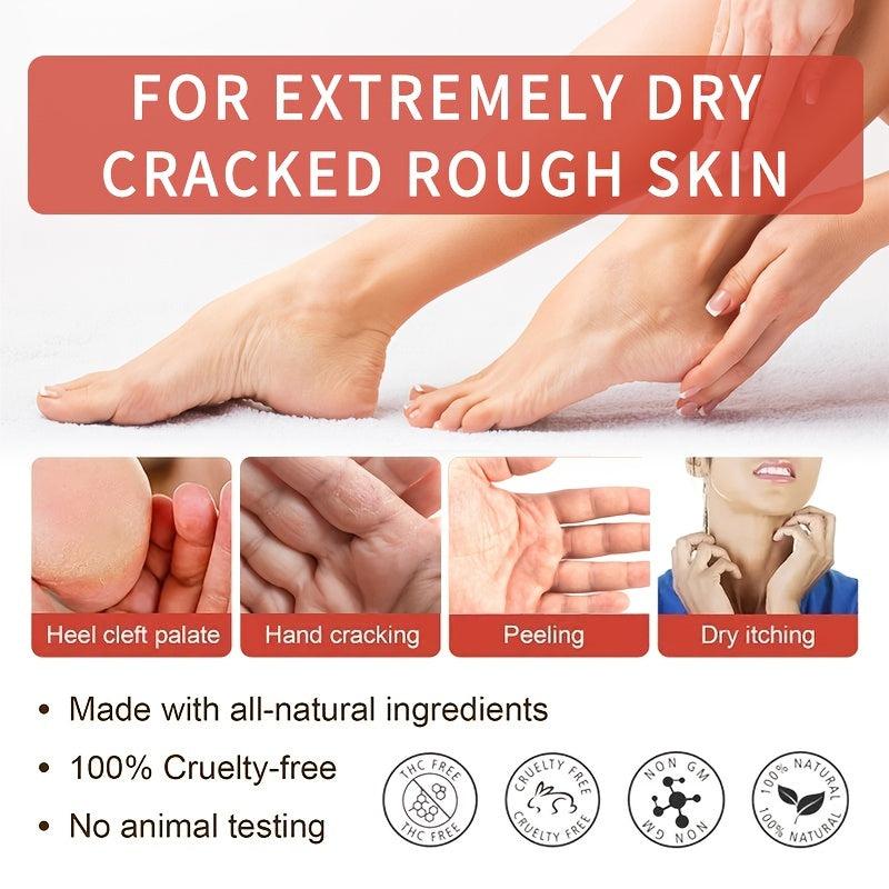 Cracked Heel Repair Cream For Dry Cracked Feet - Foot Care Dead Skin Remover