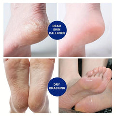 Retinol Hand Foot Cream for Dry Cracked Skin