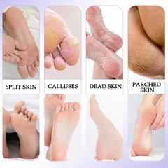 Professional Pedicure Tools Set 27 In 1 Foot Files Callus Remover For Feet