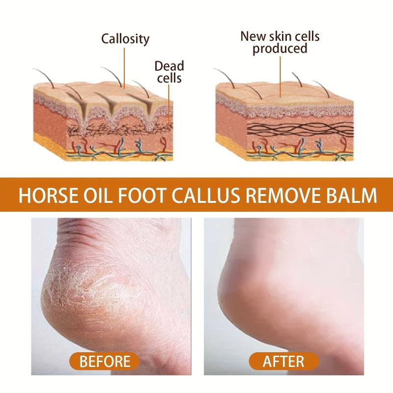Horse Foot Cream Heel Callus Remover Moisturize & Nourish Dry Skin