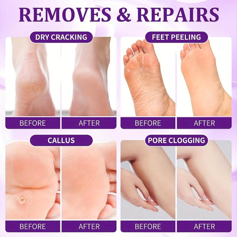 4 Step Pedicure Kit for Dry Feet