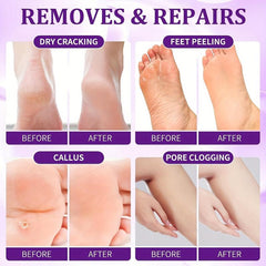 4 Step Pedicure Kit for Dry Feet