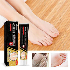 Athlete's Foot Cream For Dry Rough Cracked Skin