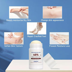 Urea Cracked Heel Balm 40 Plus Coconut Exfoliating Foot Cream