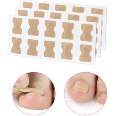 Ingrown Toenail Correction: Stickers Glue Toenail Corrector Patches