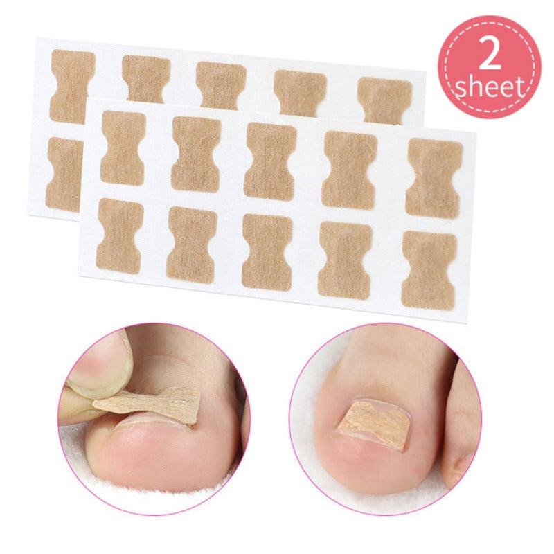 Ingrown Toenail Correction: Stickers Glue Toenail Corrector Patches