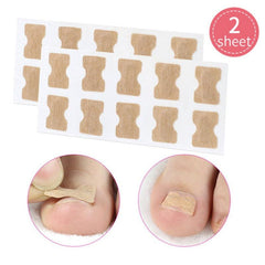 Ingrown Toenail Correction: Stickers Glue Toenail Corrector Patches