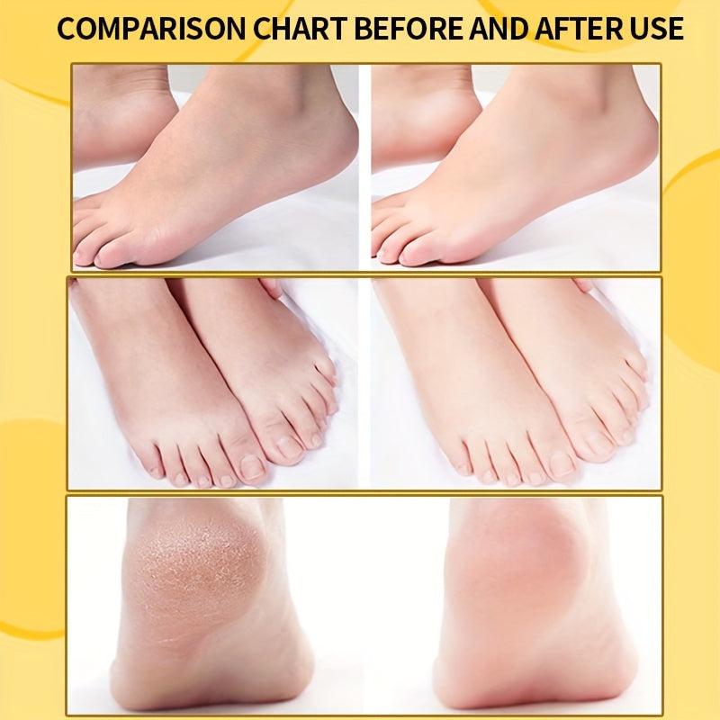 Foot Heel Cream - Moisturize & Nourish Dry Cracked Feet, Soothe Skin