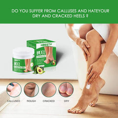 Cracked Heel Care Balm Foot Cream for Dry Skin - 20g