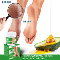 Cracked Heel Care Balm Foot Cream for Dry Skin - 20g