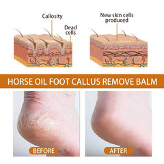 Horse Foot Cream for Callus Removal Balm