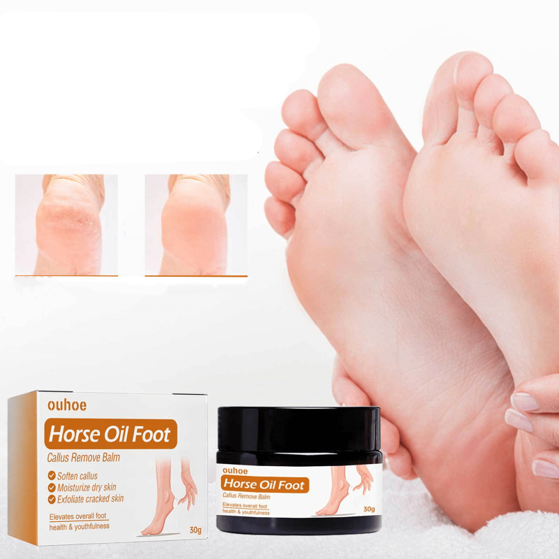 Horse Foot Cream for Callus Removal Balm