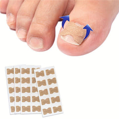 Ingrown Toenail Correction Stickers Nail Corrector Patches