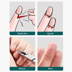Stainless Steel Dead Skin Remover Scissors