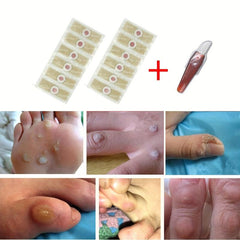 Corn Removers with Salicylic Acid - Fast Pain Removal & Protection
