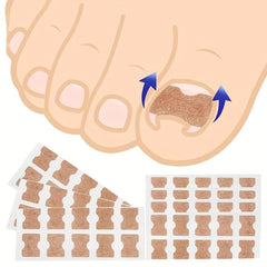 Ingrown Toenail Set with Correction Patch, Clipper, Lifter Pedicure Tool