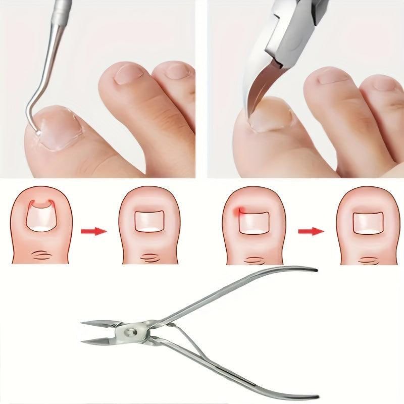 Ingrown Toenail Set with Correction Patch, Clipper, Lifter Pedicure Tool