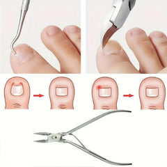 Ingrown Toenail Set with Correction Patch, Clipper, Lifter Pedicure Tool