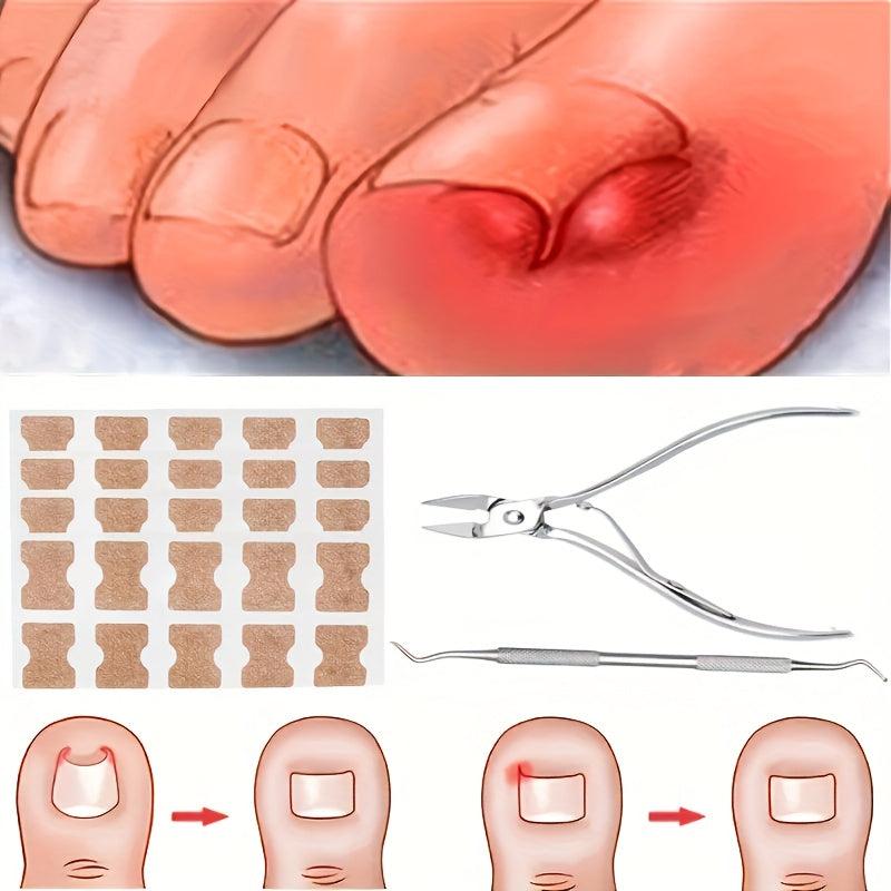 Ingrown Toenail Set with Correction Patch, Clipper, Lifter Pedicure Tool