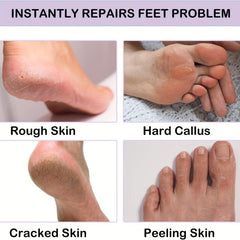 Moisturizing Gel Socks for Softening Dry Feet Skins