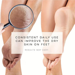 Moisturizing Foot Socks 5 Toes Spa Socks for Dry Feet Repair