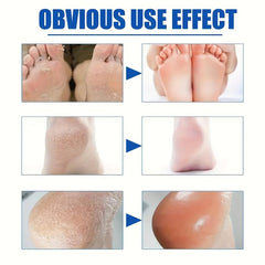Lavender Foot Cream for Cracked Feet with Tea Tree & Calendula