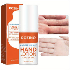 30ml Antiperspirant Hand Cream Lotion - Prevent Sweaty Hands
