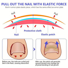 50 Pcs Ingrown Toenail Corrector Patch With File And Lifter