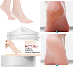 Moisturizing Foot Cream for Heel Repair, Prevents Cracked Skin