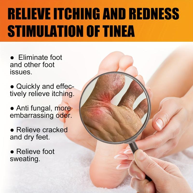 Athlete's Foot Cream for Dry Cracked Skin