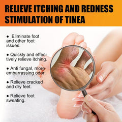 Athlete's Foot Cream for Dry Cracked Skin