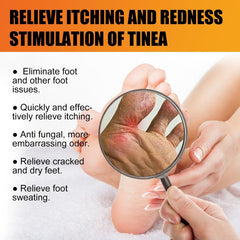 2pcs Athlete's Foot Cream Prevent Chapping Soothes Itching