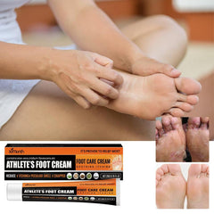 Athlete's Foot Cream for Dry Rough Cracked Skin