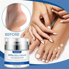 50g Urea 45% Salicylic Acid Foot Cream - Softens, Repairs, Exfoliates