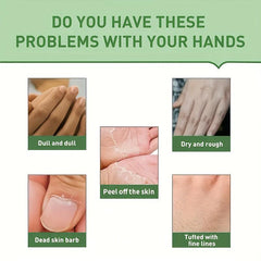 5pcs Urea Hand Cream Gift Set with Salicylic Acid Dead Skin & Callus Remover