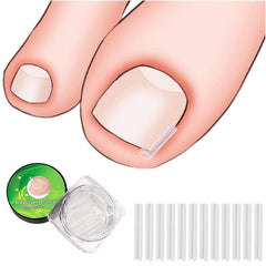 20pcs Ingrown Toenail Corrector Strips Brace Pedicure Tool