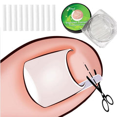 20pcs Ingrown Toenail Corrector Strips Brace Pedicure Tool