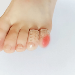 Toe Protectors Prevent Painful Toe Problems Soft & Comfortable