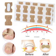 40PCS Ingrown Toenail Correction Strips Nail Care Tool