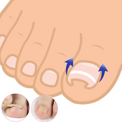 40PCS Ingrown Toenail Correction Strips Nail Care Tool