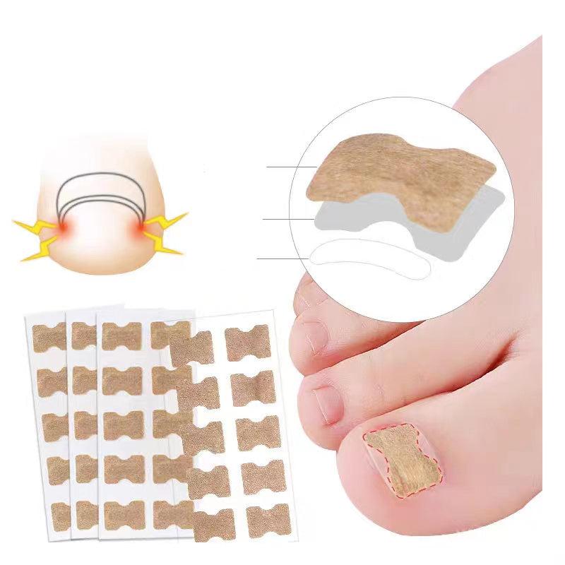 40PCS Ingrown Toenail Correction Strips Nail Care Tool