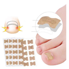 40PCS Ingrown Toenail Correction Strips Nail Care Tool