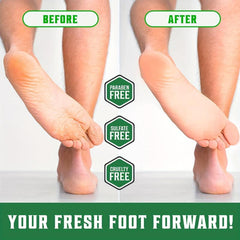 Tea Tree Foot Cream for Dry Rough Skin Repair
