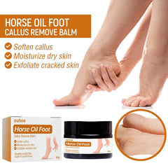 Callus Removal Balm for Dry Skin Softening