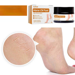 Callus Removal Balm for Dry Skin Softening